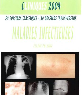 خرید و دانلود نسخه کامل کتاب Maladies infectieuses
