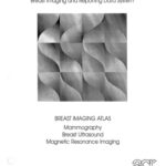 خرید و دانلود نسخه کامل کتاب Mammographiebefundung nach BI-RADS. Illustrierte Anleitung zur einheitlichen Befunderstellung von Mammographie, Mammasonographie, MR Mammographie