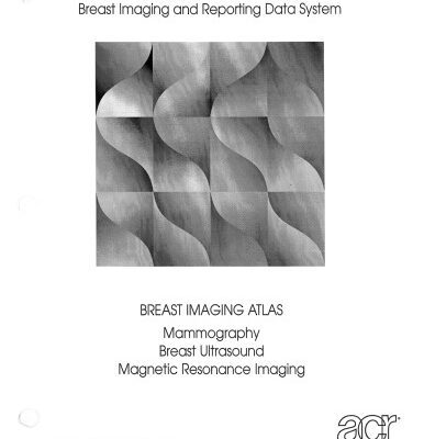 خرید و دانلود نسخه کامل کتاب Mammographiebefundung nach BI-RADS. Illustrierte Anleitung zur einheitlichen Befunderstellung von Mammographie, Mammasonographie, MR Mammographie