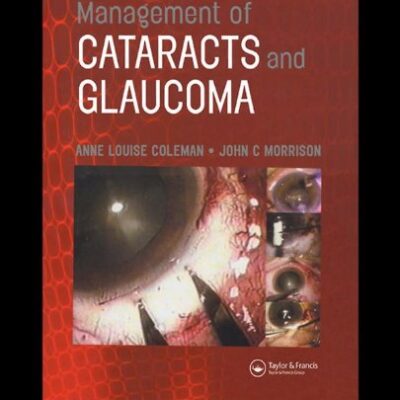 خرید و دانلود نسخه کامل کتاب Management of Cataracts and Glaucoma