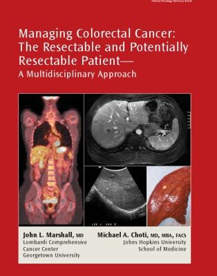 خرید و دانلود نسخه کامل کتاب Managing Colorectal Cancer: The Resectable and Potentially Resectable Patient, a Multidisciplinary Approach