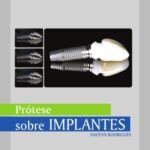 خرید و دانلود نسخه کامل کتاب Manual de protese sobre implantes – Passos Clinicos e Laboratoriais
