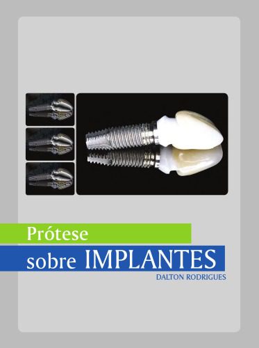 خرید و دانلود نسخه کامل کتاب Manual de protese sobre implantes – Passos Clinicos e Laboratoriais_68bbe6683a55c.jpeg خرید و دانلود نسخه کامل کتاب Manual de protese sobre implantes – Passos Clinicos e Laboratoriais