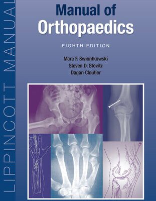 خرید و دانلود نسخه کامل کتاب Manual of Orthopaedics