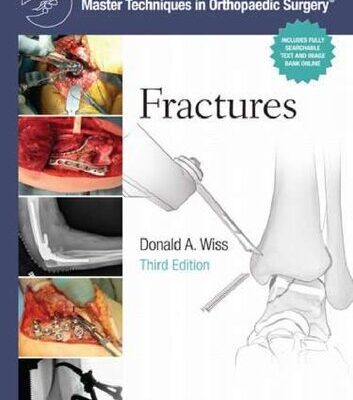 خرید و دانلود نسخه کامل کتاب Master Techniques in Orthopaedic Surgery Fractures Third Edition