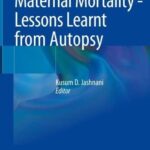 خرید و دانلود نسخه کامل کتاب Maternal Mortality – Lessons Learnt from Autopsy