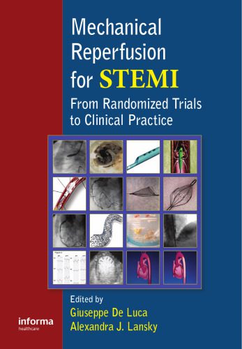 خرید و دانلود نسخه کامل کتاب Mechanical Reperfusion for STEMI: From Randomized Trials to Clinical Practice_68bcc919473fc.jpeg خرید و دانلود نسخه کامل کتاب Mechanical Reperfusion for STEMI: From Randomized Trials to Clinical Practice