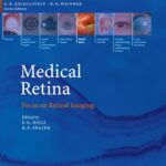 خرید و دانلود نسخه کامل کتاب Medical Retina: Focus on Retinal Imaging