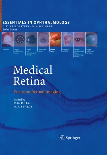 خرید و دانلود نسخه کامل کتاب Medical Retina: Focus on Retinal Imaging_68b65ca38a140.jpeg خرید و دانلود نسخه کامل کتاب Medical Retina: Focus on Retinal Imaging