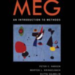 خرید و دانلود نسخه کامل کتاب MEG: An Introduction to Methods