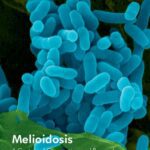 خرید و دانلود نسخه کامل کتاب Melioidosis – A Century of Observation and Research
