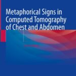 خرید و دانلود نسخه کامل کتاب Metaphorical Signs in Computed Tomography of Chest and Abdomen