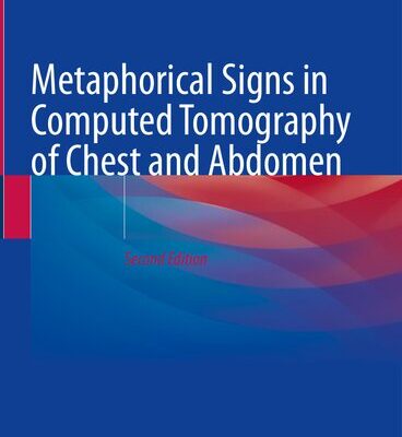 خرید و دانلود نسخه کامل کتاب Metaphorical Signs in Computed Tomography of Chest and Abdomen