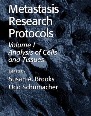 خرید و دانلود نسخه کامل کتاب Metastasis Research Protocols Volume 1 : Analysis of Cells & Tissues (Methods in Molecular Medicine)