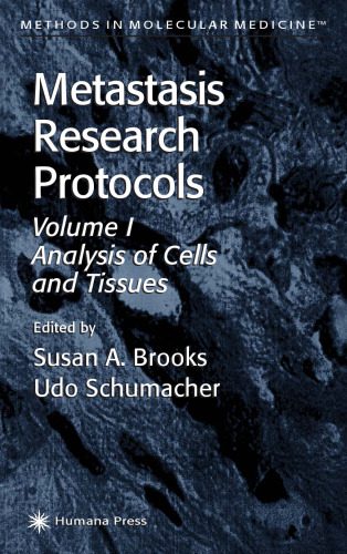 خرید و دانلود نسخه کامل کتاب Metastasis Research Protocols Volume 1 : Analysis of Cells & Tissues (Methods in Molecular Medicine)_68bad3bd55c05.jpeg خرید و دانلود نسخه کامل کتاب Metastasis Research Protocols Volume 1 : Analysis of Cells & Tissues (Methods in Molecular Medicine)