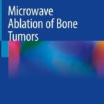 خرید و دانلود نسخه کامل کتاب Microwave Ablation of Bone Tumors