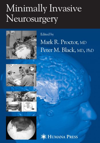 خرید و دانلود نسخه کامل کتاب Minimally Invasive Neurosurgery_68bb4db00dfd9.jpeg خرید و دانلود نسخه کامل کتاب Minimally Invasive Neurosurgery