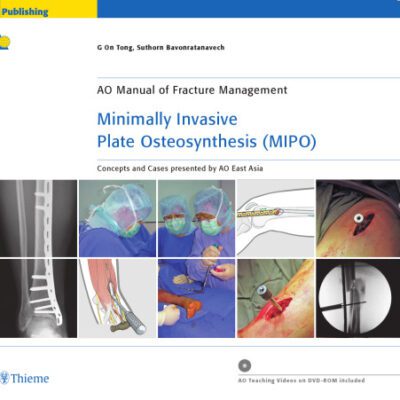 خرید و دانلود نسخه کامل کتاب Minimally Invasive Plate Osteosynthesis (MIPO)