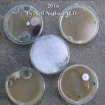 خرید و دانلود نسخه کامل کتاب Mold & Mycotoxins: Current Evaluation and Treatment 2016