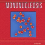 خرید و دانلود نسخه کامل کتاب Mononucleosis (Deadly Diseases and Epidemics)
