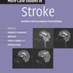 خرید و دانلود نسخه کامل کتاب More Case Studies in Stroke: Common and Uncommon Presentations