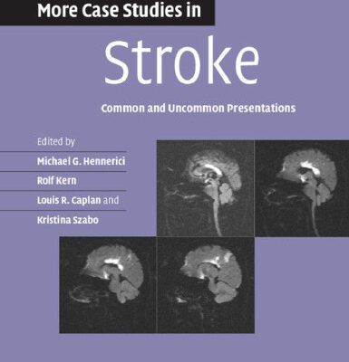 خرید و دانلود نسخه کامل کتاب More Case Studies in Stroke: Common and Uncommon Presentations