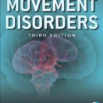 خرید و دانلود نسخه کامل کتاب Movement disorders