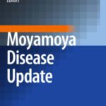 خرید و دانلود نسخه کامل کتاب Moyamoya Disease Update