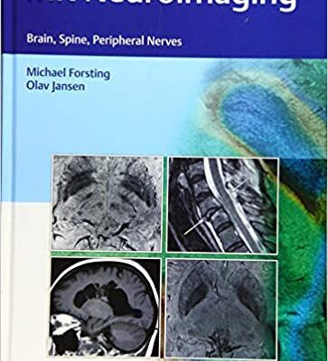 خرید و دانلود نسخه کامل کتاب MR Neuroimaging Brain, Spine, and Peripheral Nerves