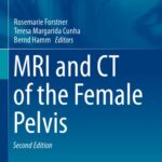 خرید و دانلود نسخه کامل کتاب MRI and CT of the Female Pelvis