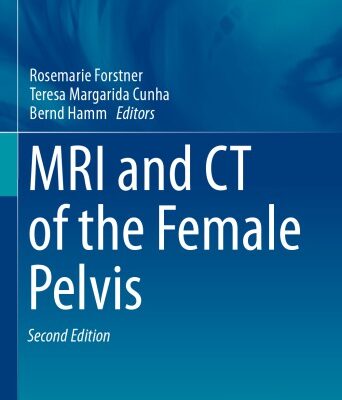 خرید و دانلود نسخه کامل کتاب MRI and CT of the Female Pelvis