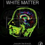خرید و دانلود نسخه کامل کتاب MRI Atlas of Human White Matter