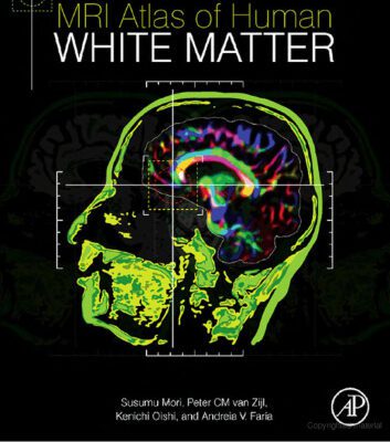 خرید و دانلود نسخه کامل کتاب MRI Atlas of Human White Matter