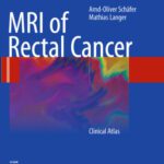 خرید و دانلود نسخه کامل کتاب MRI of Rectal Cancer: Clinical Atlas