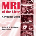 خرید و دانلود نسخه کامل کتاب MRI of the Liver: A Practical Guide
