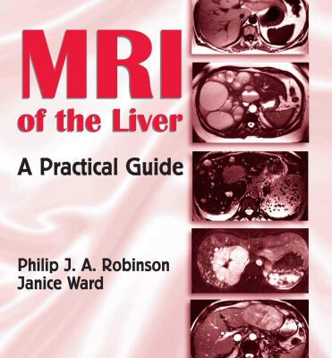 خرید و دانلود نسخه کامل کتاب MRI of the Liver: A Practical Guide