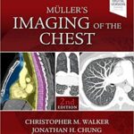 خرید و دانلود نسخه کامل کتاب Muller’s Imaging of the Chest (2nd Edition)