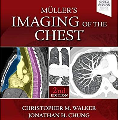 خرید و دانلود نسخه کامل کتاب Muller’s Imaging of the Chest (2nd Edition)
