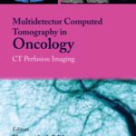 خرید و دانلود نسخه کامل کتاب Multi-Detector Computed Tomography in Oncology: CT Perfusion Imaging