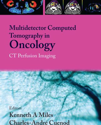 خرید و دانلود نسخه کامل کتاب Multi-Detector Computed Tomography in Oncology: CT Perfusion Imaging