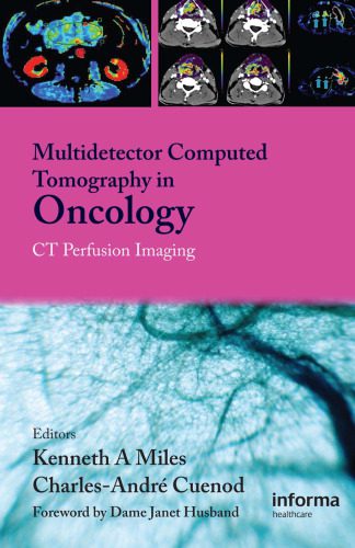 خرید و دانلود نسخه کامل کتاب Multi-Detector Computed Tomography in Oncology: CT Perfusion Imaging_68b5b50b39198.jpeg خرید و دانلود نسخه کامل کتاب Multi-Detector Computed Tomography in Oncology: CT Perfusion Imaging