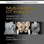 خرید و دانلود نسخه کامل کتاب Multi-Detector CT Imaging Handbook, Two Volume Set