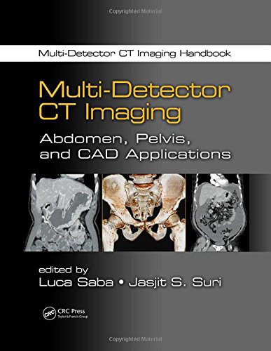خرید و دانلود نسخه کامل کتاب Multi-Detector CT Imaging Handbook, Two Volume Set_68b61e192238d.jpeg خرید و دانلود نسخه کامل کتاب Multi-Detector CT Imaging Handbook, Two Volume Set