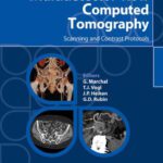 خرید و دانلود نسخه کامل کتاب Multidetector-Row Computed Tomography Scanning and Contrast Protocols
