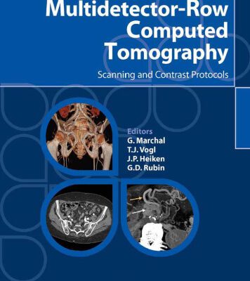 خرید و دانلود نسخه کامل کتاب Multidetector-Row Computed Tomography Scanning and Contrast Protocols