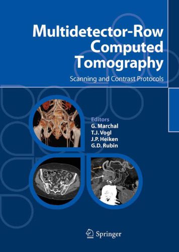 خرید و دانلود نسخه کامل کتاب Multidetector-Row Computed Tomography Scanning and Contrast Protocols_68b849df19c74.jpeg خرید و دانلود نسخه کامل کتاب Multidetector-Row Computed Tomography Scanning and Contrast Protocols