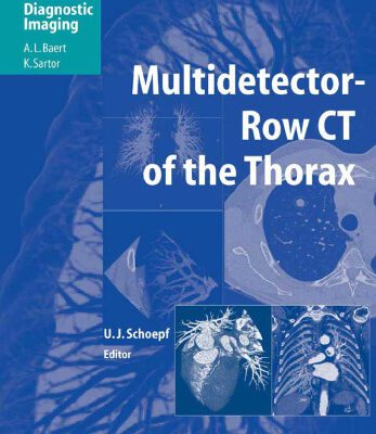خرید و دانلود نسخه کامل کتاب Multidetector-Row CT of the Thorax (Medical Radiology   Diagnostic Imaging)