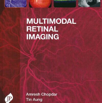 خرید و دانلود نسخه کامل کتاب Multimodal Retinal Imaging