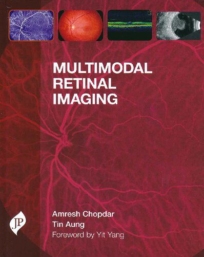 خرید و دانلود نسخه کامل کتاب Multimodal Retinal Imaging_68b62fad508ac.jpeg خرید و دانلود نسخه کامل کتاب Multimodal Retinal Imaging