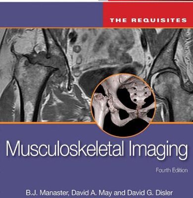 خرید و دانلود نسخه کامل کتاب Musculoskeletal Imaging: The Requisites